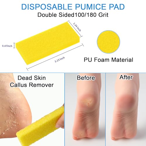 LVKN Disposable Pedicure Kit 5-in-1 (Nail Buffer, Pumice Pad, Nail File 100/180 Grit, Wood Stick and Toe Separators) Complete Pedicure Kit for Salon or Home Use.