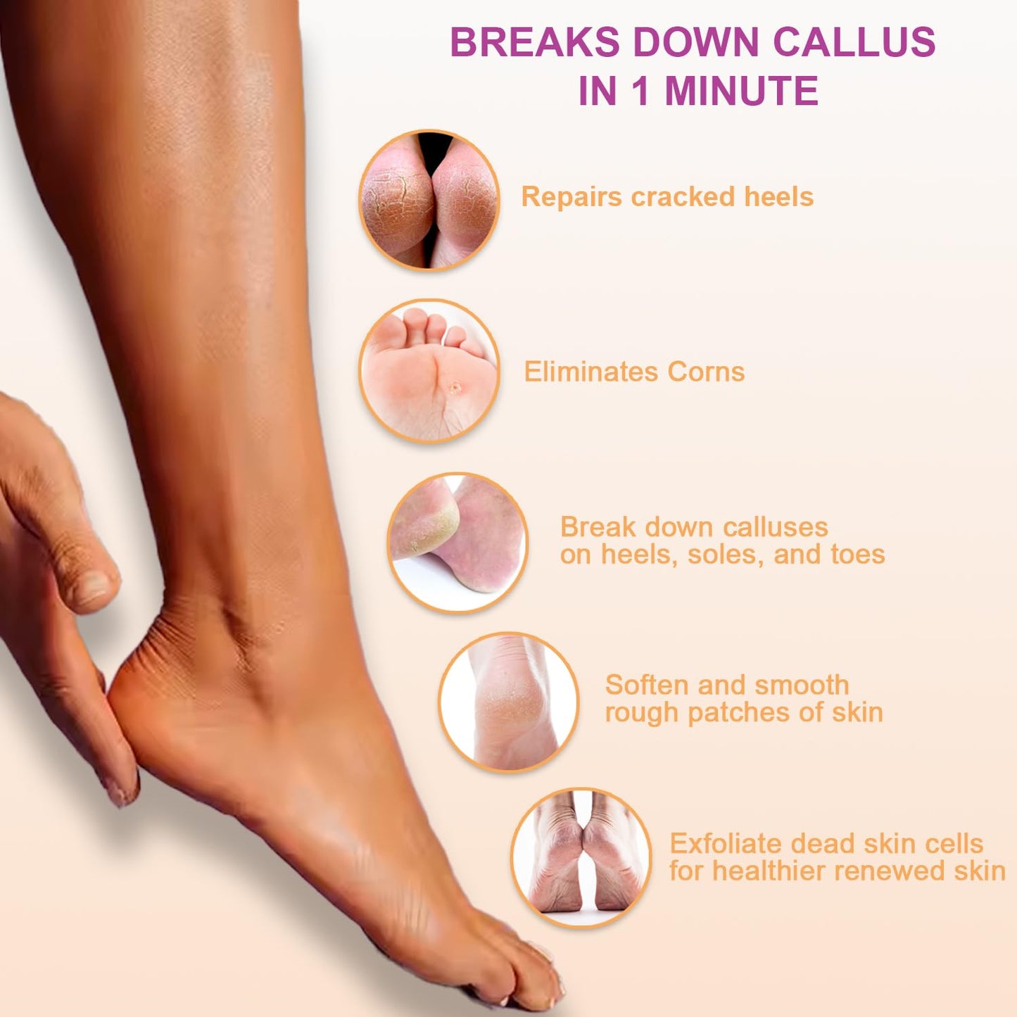 Extra Strength Callus Remover Gel: Professional-Grade, Fast-Acting Formula for Effortless, Smooth Feet 8oz Made in USA