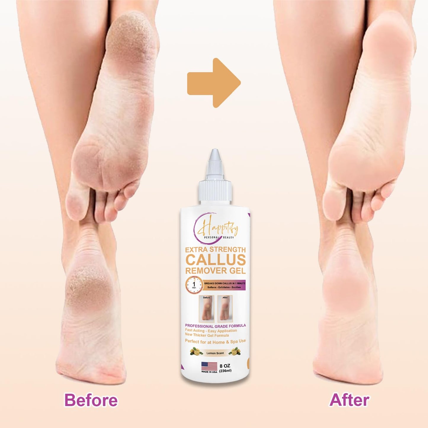 Extra Strength Callus Remover Gel: Professional-Grade, Fast-Acting Formula for Effortless, Smooth Feet 8oz Made in USA